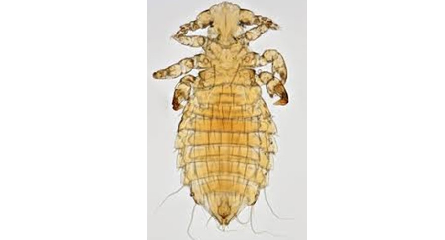 A detailed view of a male sucking louse