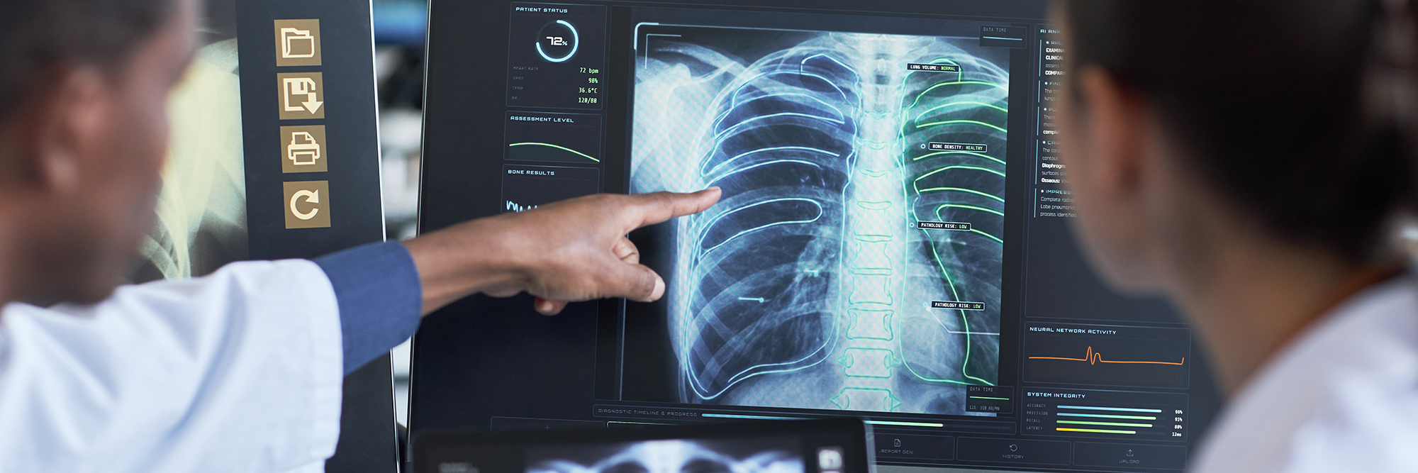 Chest x-ray