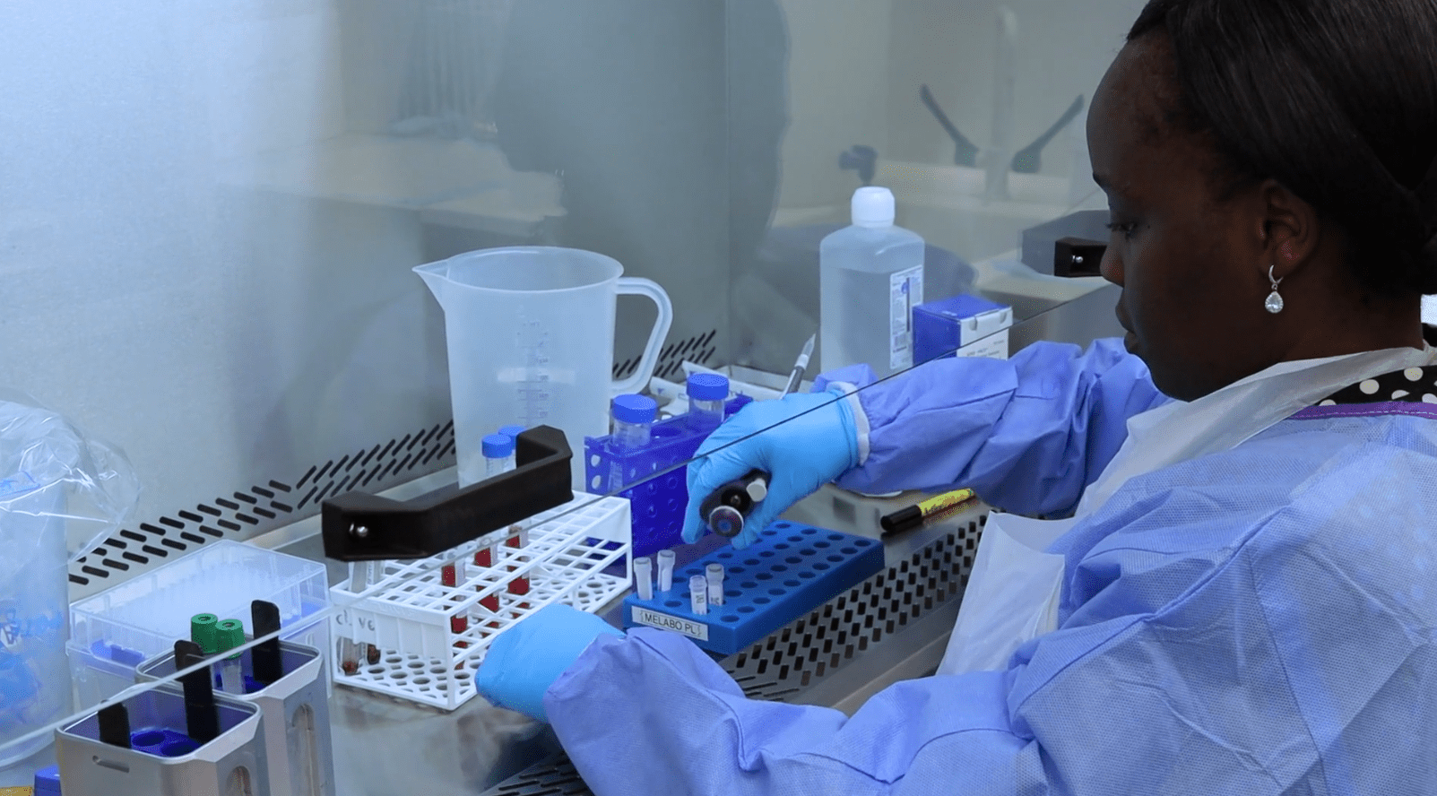 Doty Ojwach lab work