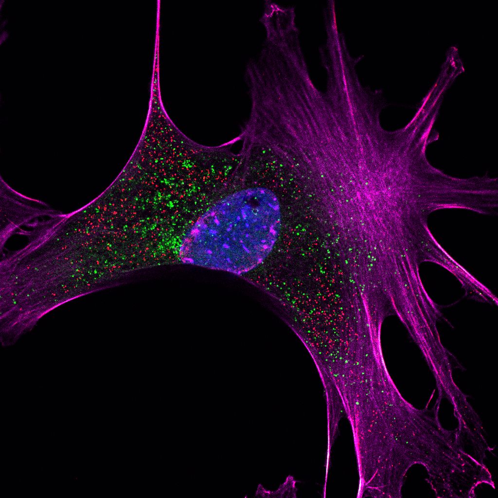 Micrograph image that shows four different structures in a cell that are important in understanding diseases associated with neurodegeneration.