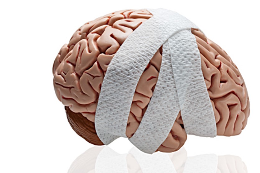 Brain image.jpg Brain image.jpg