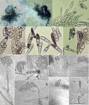 Fungi microscope images.jpg