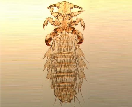 Lice from gerbils.jpg