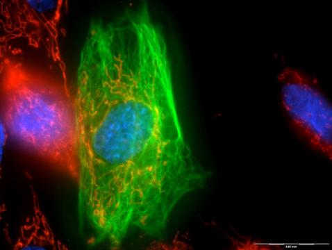 Microscopy images of cells