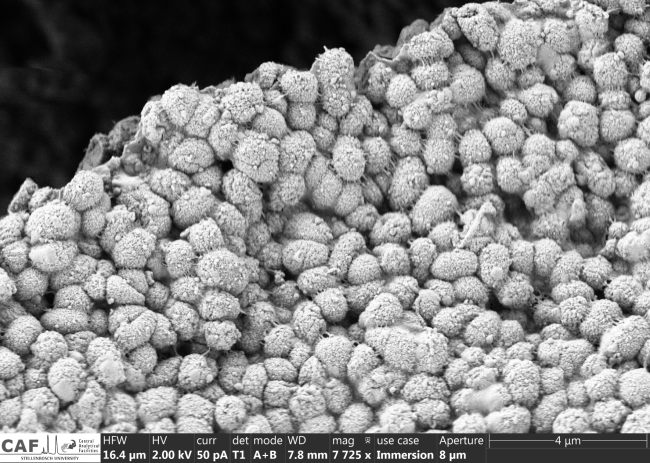 The new species, Dedyshia acidiphilia, was isolated from soil collected in the Kogelberg Nature Reserve in the Western Cape, South Africa