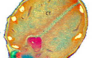 Microscopic image of the longitudinal sections of a recalcitrant Oxalis seed with multiple cavities (CV) in the cotyledons