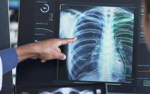 Chest x-ray
