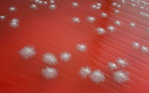What is Microbiology?