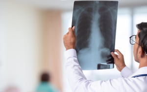 A doctor checks a chest x-ray film in a hospital.