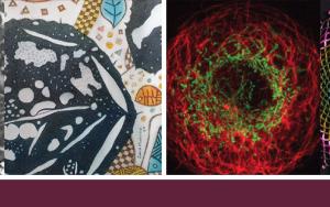 SU/Kayamandi initiative uses art to change negative attitudes towards mental illness