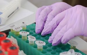 TB is alweer die dodelikste siekte in Afrika – wat het skeef geloop