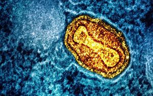 Mpox outbreak in Africa was neglected – it could now turn into the next global pandemic