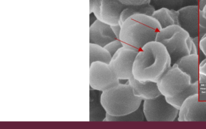 Nuwe navorsing: Nuwe lipopeptied is Staphylococcus areus se doodsteek