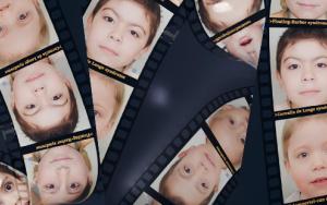 SU contributes to groundbreaking study on ultra-rare diseases