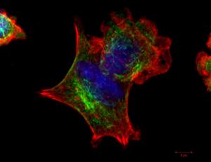 PLL2_Maximum-intensity-projection