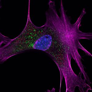 Micrograph image that shows four different structures in a cell that are important in understanding diseases associated with neurodegeneration.