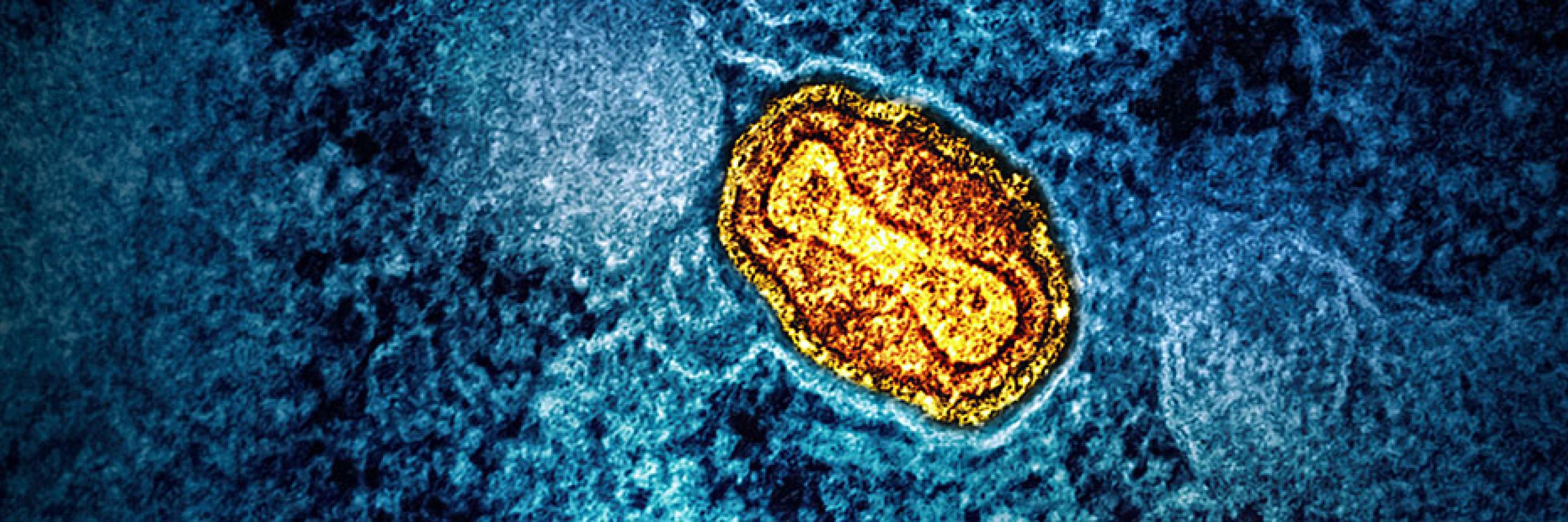 Mpox outbreak in Africa was neglected – it could now turn into the next ...