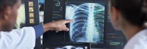 Chest x-ray