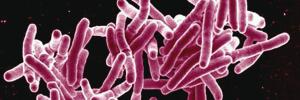 Afrika-wetenskaplikes ‘n tree nader aan ‘n toets wat TB in minute diagnoseer