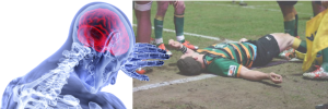 Brain Injury Awareness Month: “Not all wounds are visible”