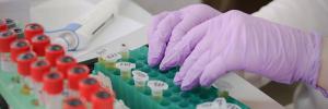 How pooled testing can increase access to essential laboratory tests in Africa