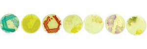 Microbes captured in living display