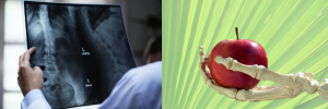 Osteoporosis: how do we keep our bones healthy?