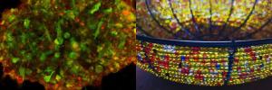 ‘Science meets art’ exhibit addresses stigma of illness