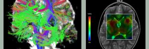 State-of-the-art scanner expands brain imaging to whole body