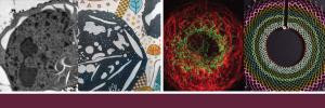 SU/Kayamandi initiative uses art to change negative attitudes towards mental illness