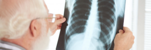 World Tuberculosis Day: TB research still crucial in a time of Covid-19