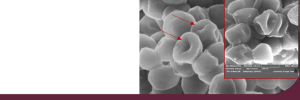 Nuwe navorsing: Nuwe lipopeptied is Staphylococcus areus se doodsteek