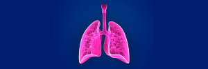 A picture of a posterior view of the lungs against a blue background.
