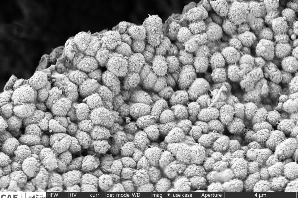 The new species, Dedyshia acidiphilia, was isolated from soil collected in the Kogelberg Nature Reserve in the Western Cape, South Africa