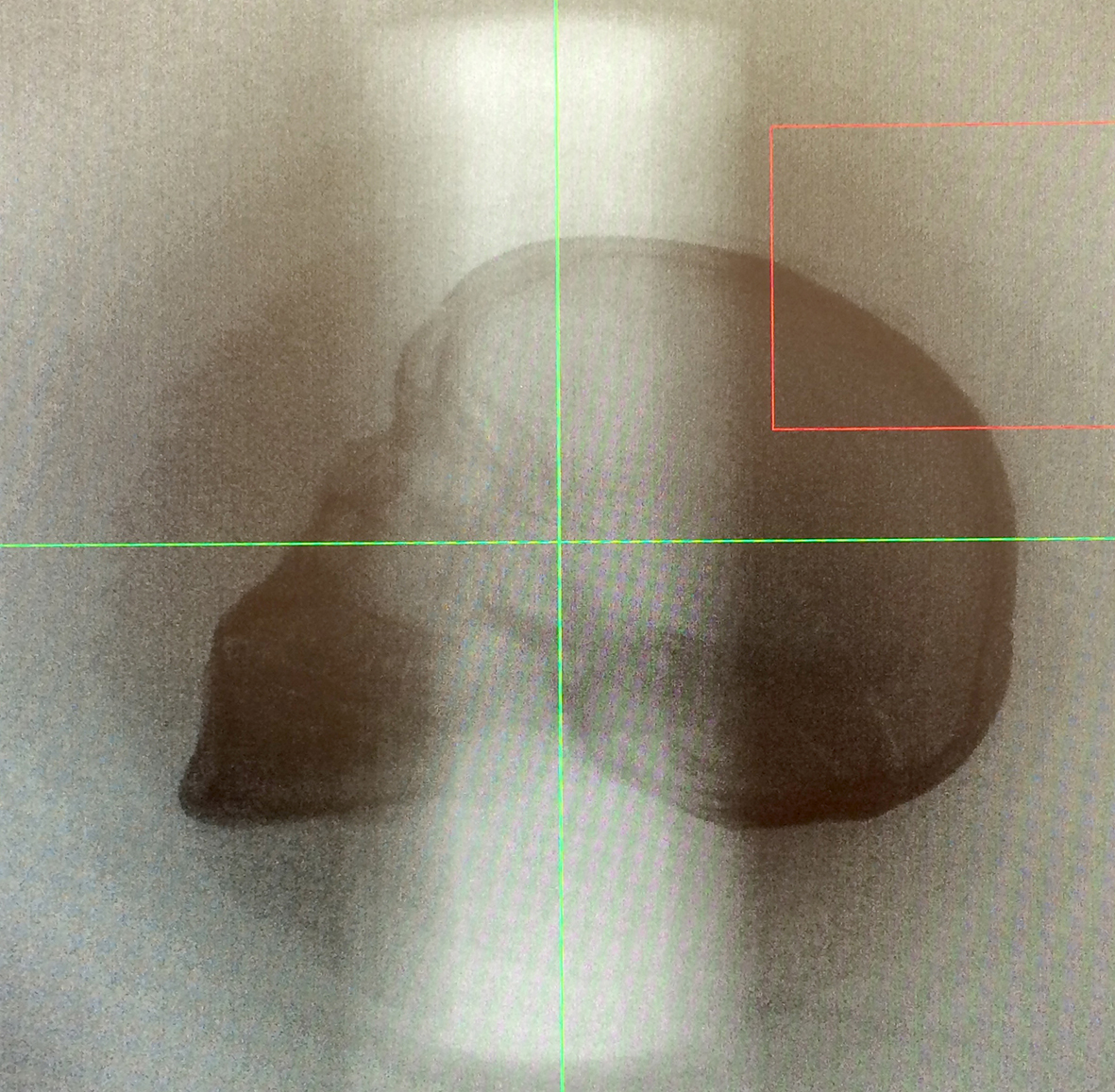 04_Smith_MicroCT_onscreen01