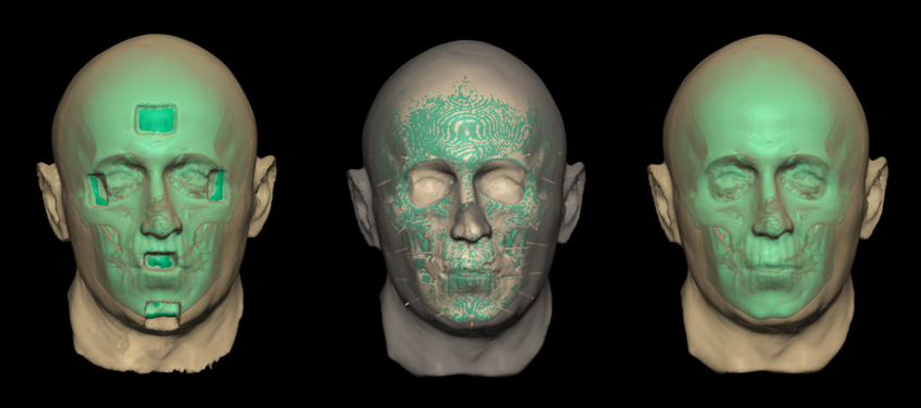 06_Smith_Skull_registration
